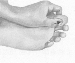 阳痿按摩部位图解