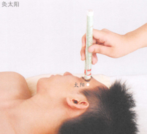 健脑益智艾灸哪个部位图解