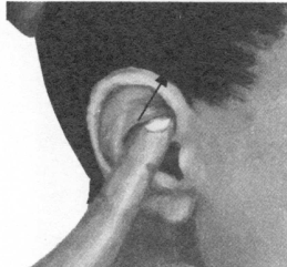 耳鸣-耳痛按摩部位图解