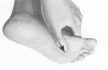 腹泻按摩部位图解