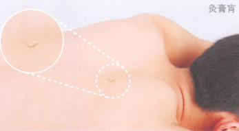 肺结核艾灸哪个部位图解