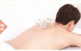 冠心病拔罐部位图解