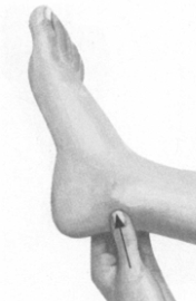 失眠症按摩部位图解