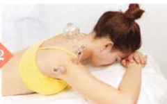 空调病拔罐部位图解