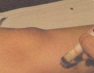 闭经艾灸哪个部位图解