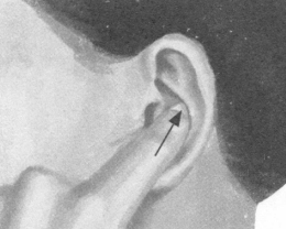 高血压按摩部位图解