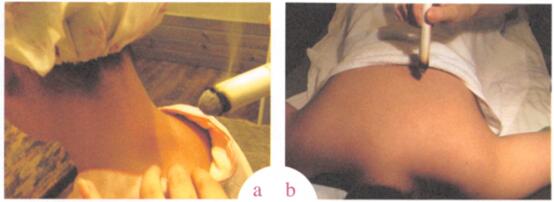 风热感冒艾灸哪个部位图解