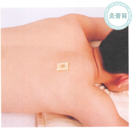 肺心病艾灸哪个部位图解