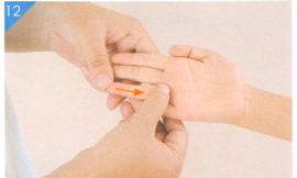 小儿风疹按摩部位图解