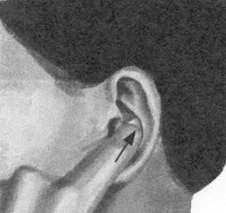 耳鸣-耳痛按摩部位图解