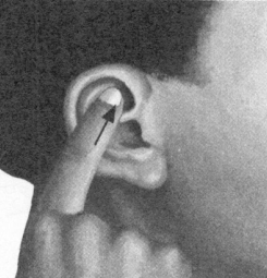 耳鸣-耳痛按摩部位图解