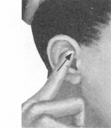 高脂血症按摩部位图解