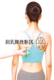 急性乳腺炎刮痧部位图解