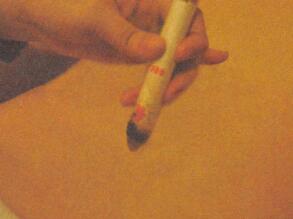 小儿疝气艾灸哪个部位图解