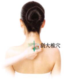 咽喉肿痛刮痧部位图解