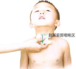 百日咳刮痧部位图解