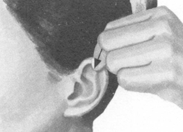 高血压按摩部位图解