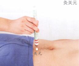 糖尿病艾灸哪个部位图解