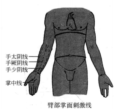 飞针技术臂部刺激线
