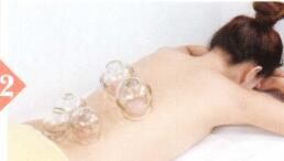 肌肉萎缩拔罐部位图解