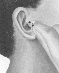 颈椎病按摩部位图解