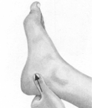 经前期综合征按摩部位图解