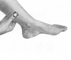 高脂血症按摩部位图解