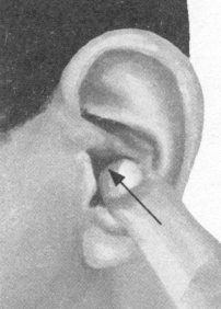 咳喘病按摩部位图解