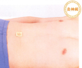 便秘艾灸哪个部位图解