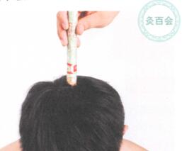 冬季艾灸艾灸哪个部位图解