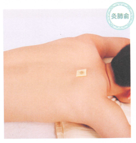 哮喘艾灸哪个部位图解