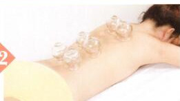 神经衰弱拔罐部位图解