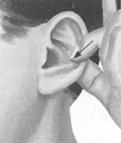 风湿病按摩部位图解