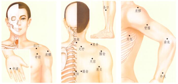 肩周炎刮痧部位图解