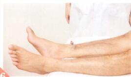 低血压拔罐部位图解