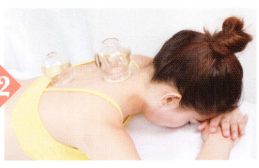 癫痫拔罐部位图解