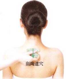 扁平疣刮痧部位图解