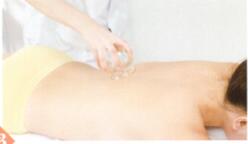 强直性脊柱炎拔罐部位图解