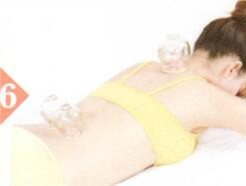 耳鸣耳聋拔罐部位图解