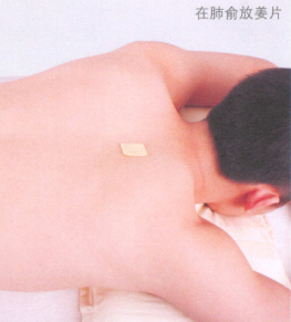 慢性支气管炎艾灸哪个部位图解