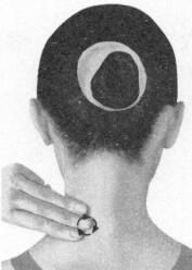 近视按摩部位图解