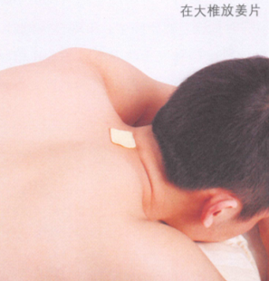 颈椎病艾灸哪个部位图解