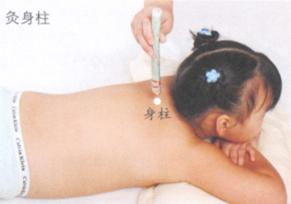小儿保健艾灸哪个部位图解