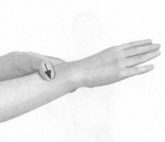 胃肠炎按摩部位图解