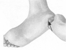 前列腺疾病按摩部位图解