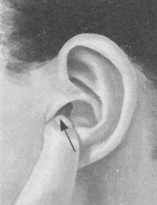 咳喘病按摩部位图解