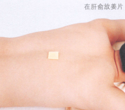 斑秃艾灸哪个部位图解