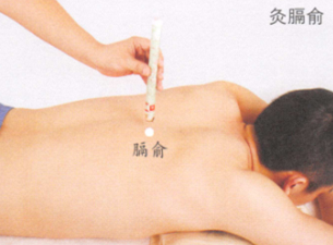 呃逆艾灸哪个部位图解