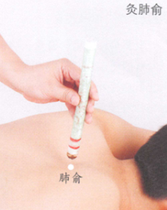 鼻出血艾灸哪个部位图解