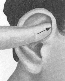 鼻炎按摩部位图解